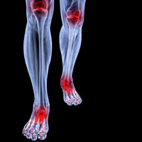 Knee Ankle Joint Pain