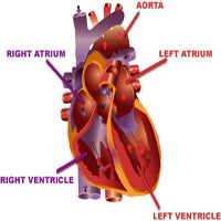 Heart Disease