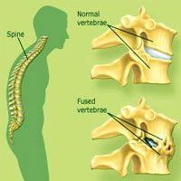 Back Neck Waist Pain